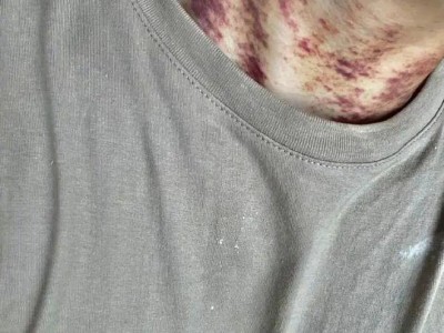 杭州月租6万出租房甲醛超标，房东不退还押金引纠纷