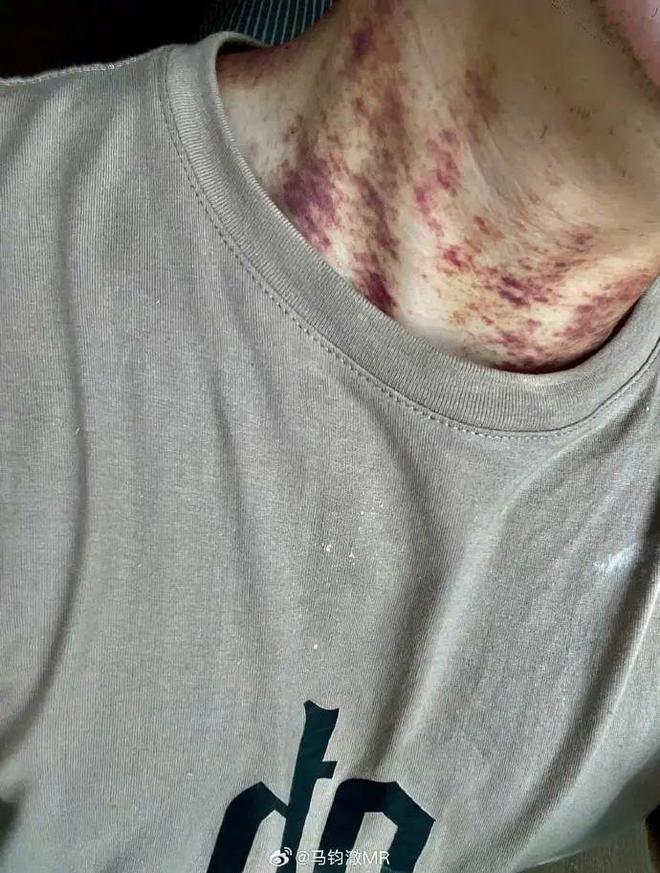 直租信息_个人直租监管空白_高价租房甲醛超标纠纷